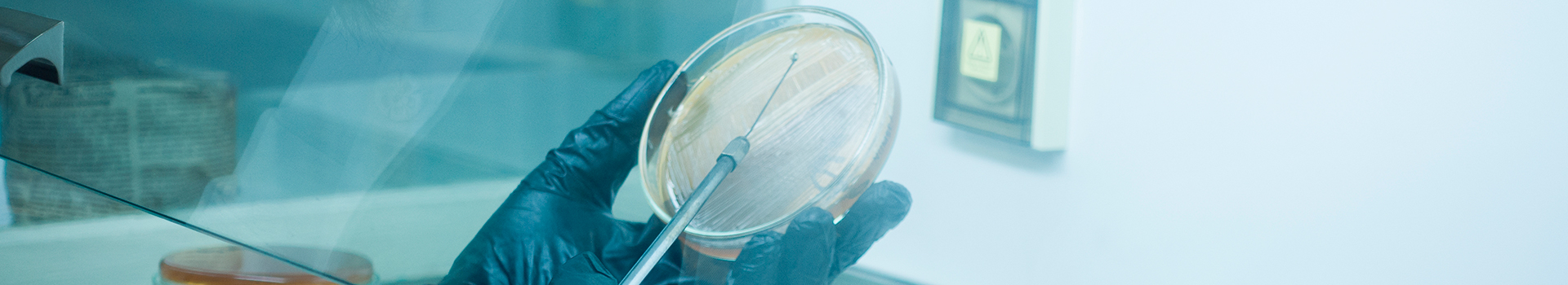 Curso Gratis de Microbiología Clínica: Fundamentos y Aplicaciones en Procesos Infecciosos Curso Gratis de Microbiología Clínica: Fundamentos y Aplicaciones en Procesos Infecciosos