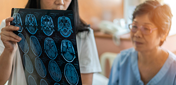 Curso Gratis de Intervención Cognitiva y Áreas Afectadas en el Alzheimer